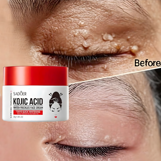 Kojic Acid Whiten Freckles Face Cream